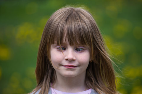 Young girl with crossed eyes